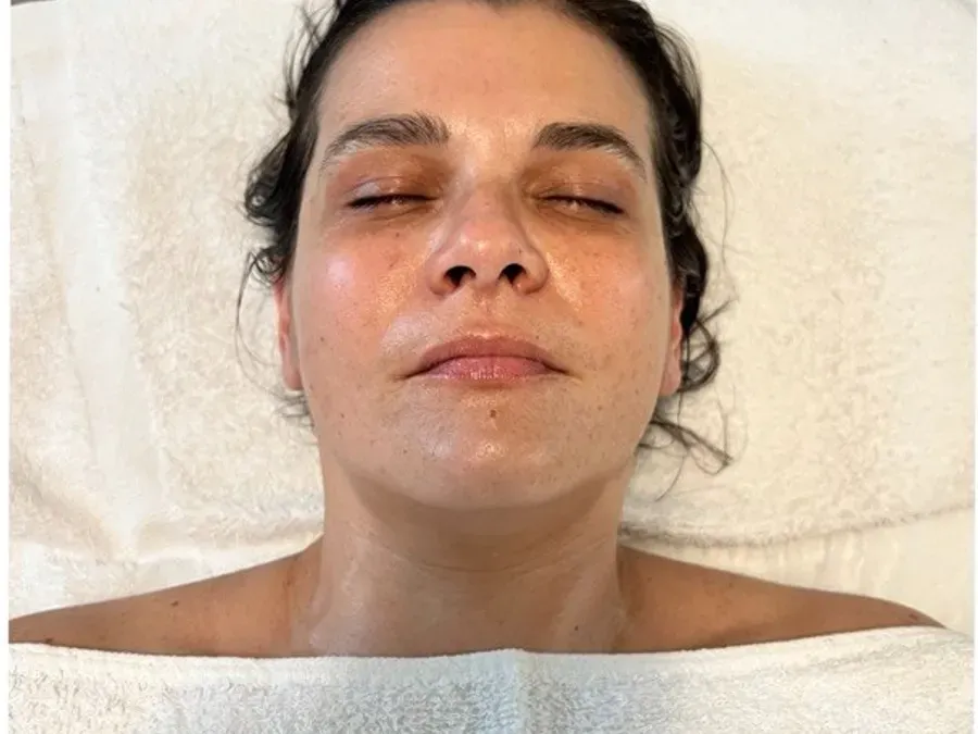 After: sculptural buccal facial massage