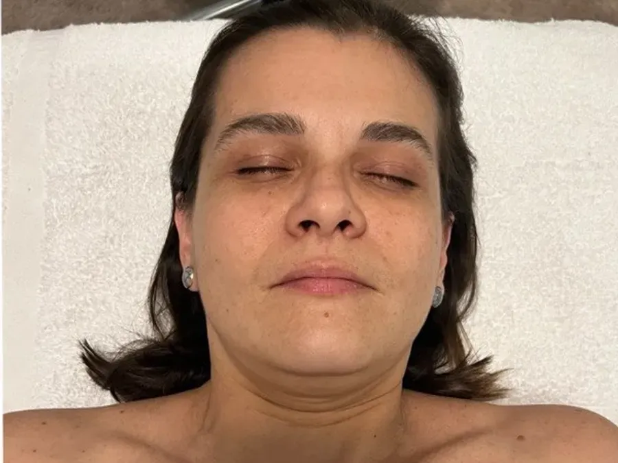 Before: sculptural buccal facial massage