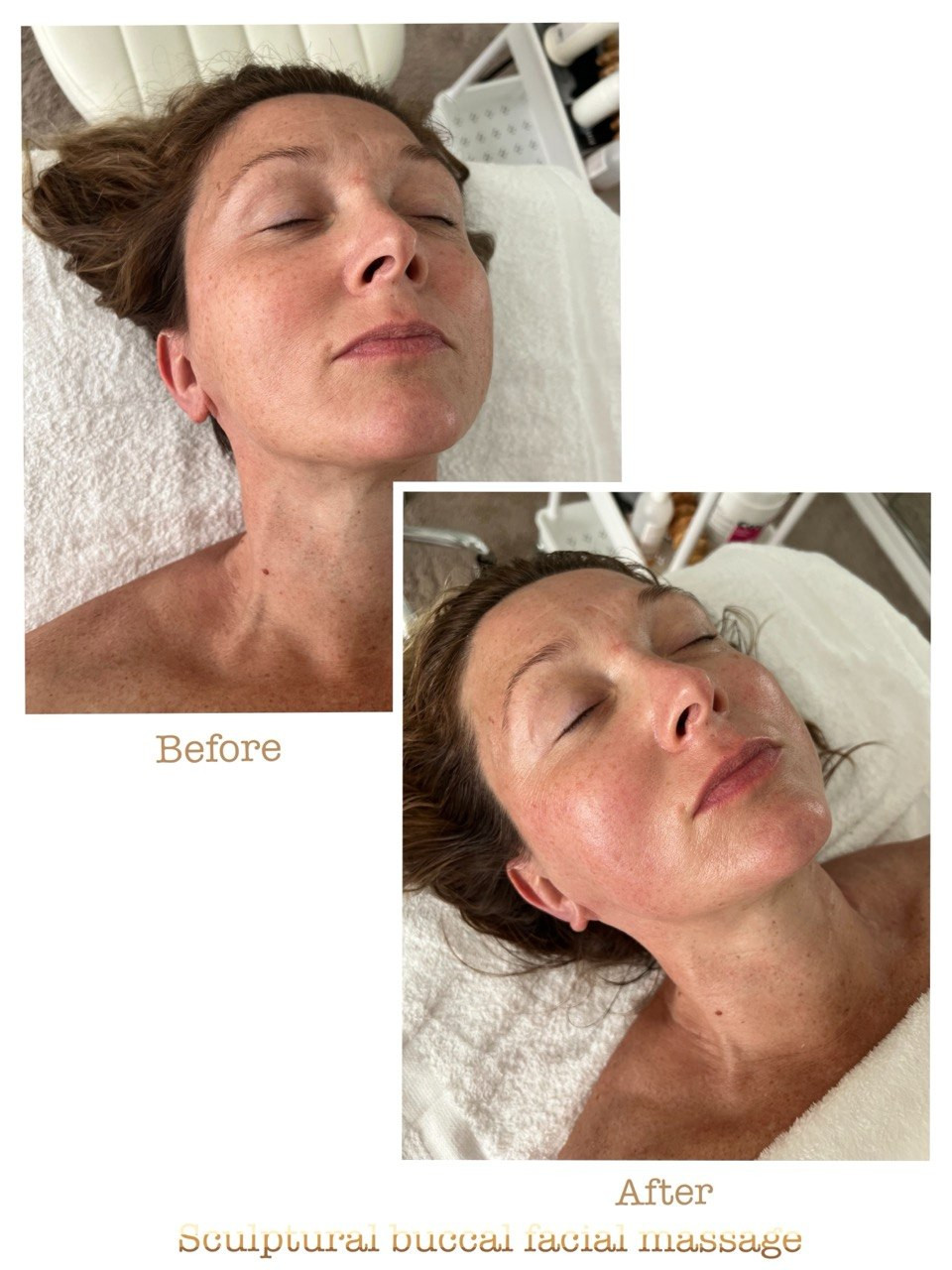 Before and after example 4 from sculptural buccal facial massage at Nova Vita Esthetics