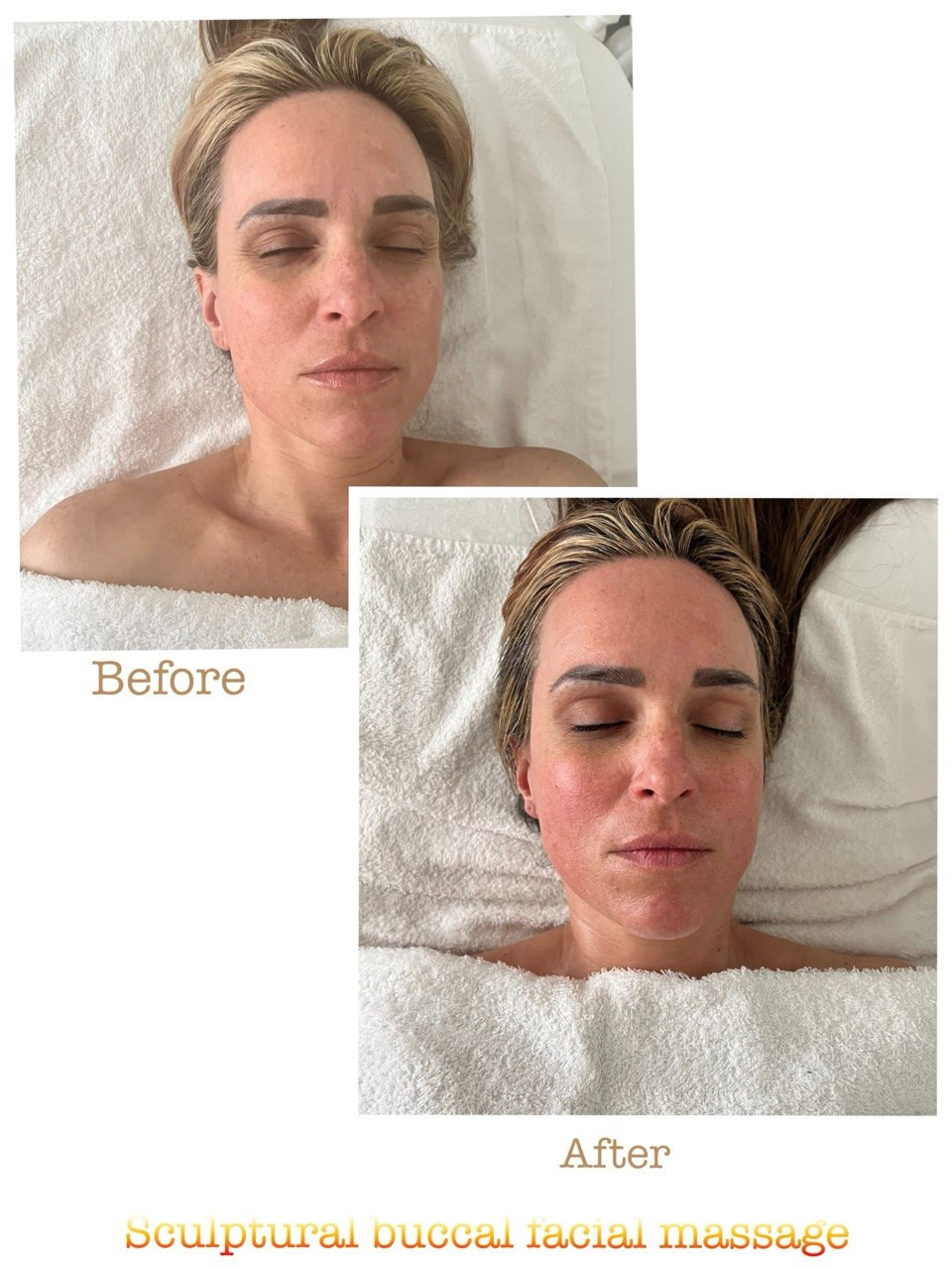 Before and after example 5 from sculptural buccal facial massage at Nova Vita Esthetics