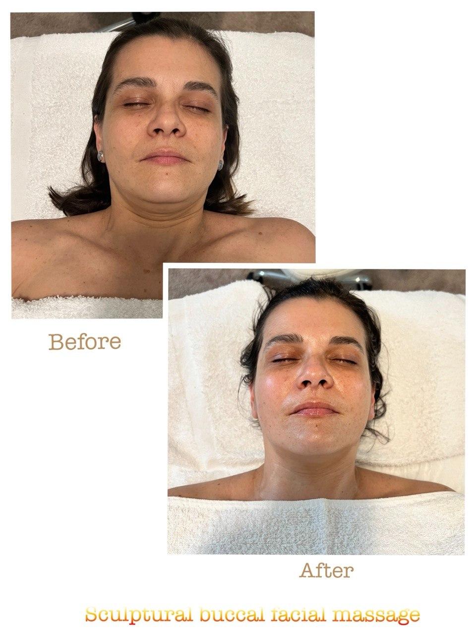 Before and after example 1 from sculptural buccal facial massage at Nova Vita Esthetics