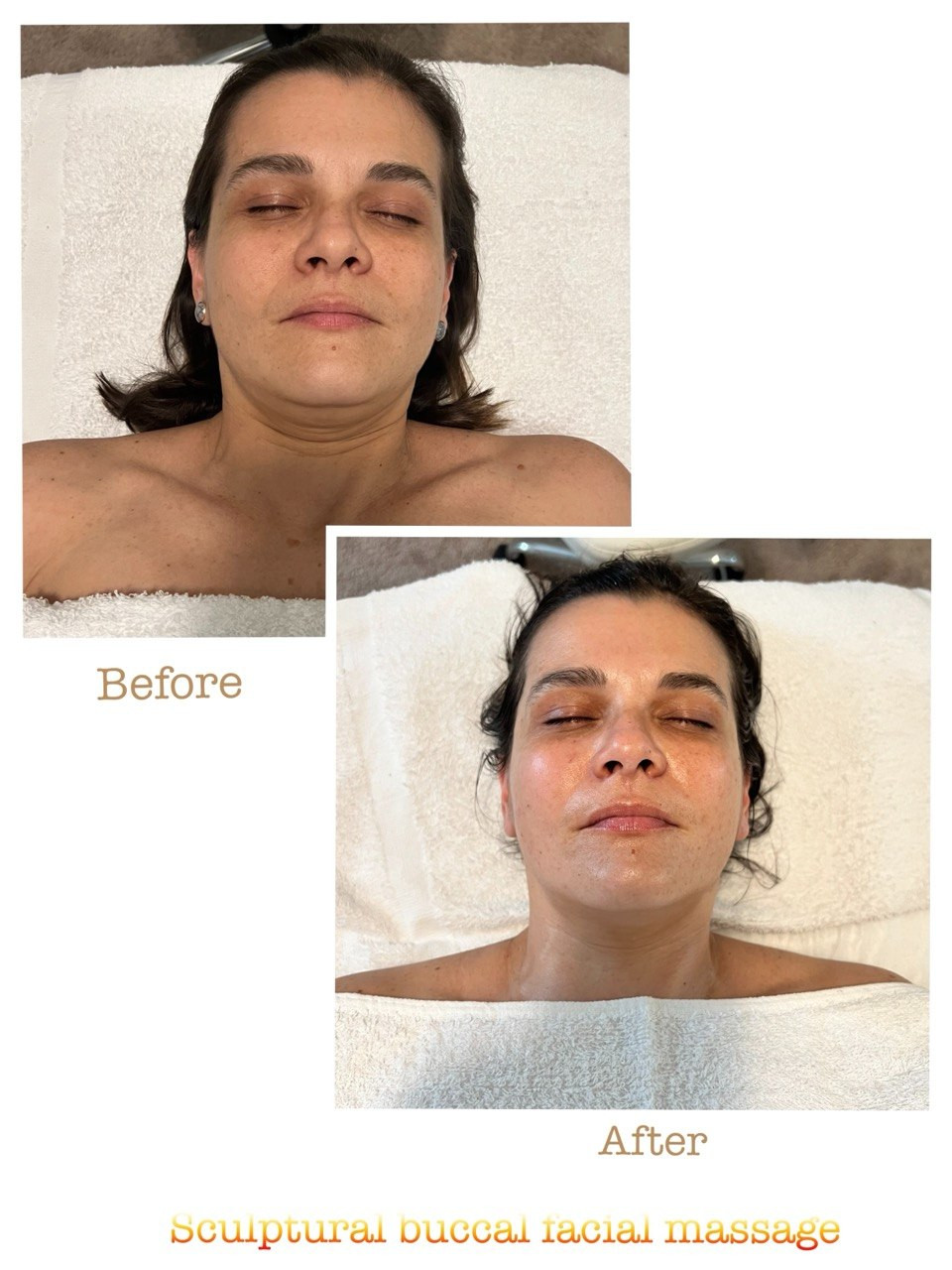 Before and after example 1 from sculptural buccal facial massage at Nova Vita Esthetics
