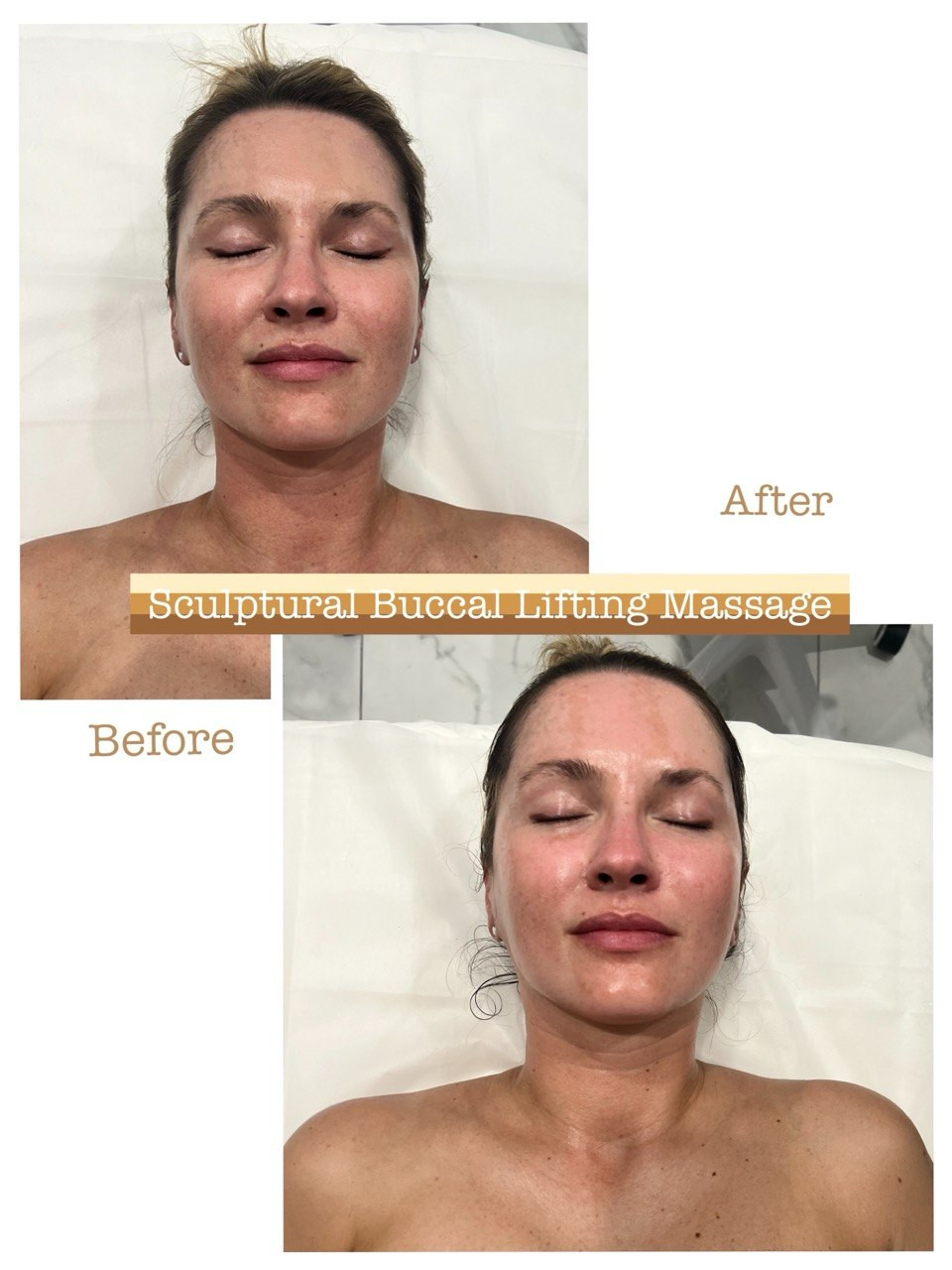 Before and after example 2 from sculptural buccal facial massage at Nova Vita Esthetics