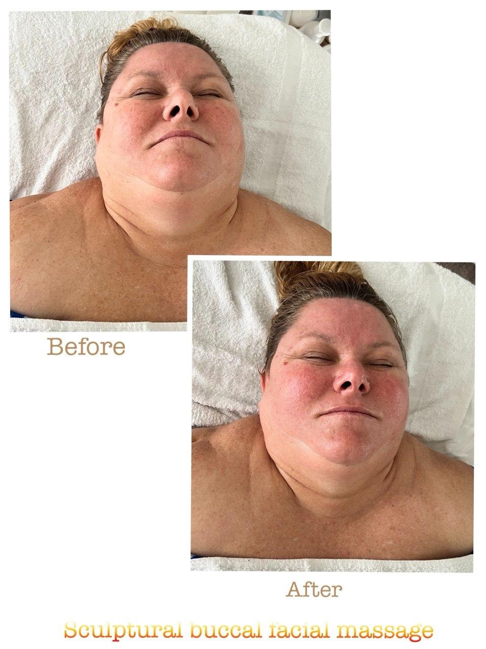 Before and after example 3 from sculptural buccal facial massage at Nova Vita Esthetics
